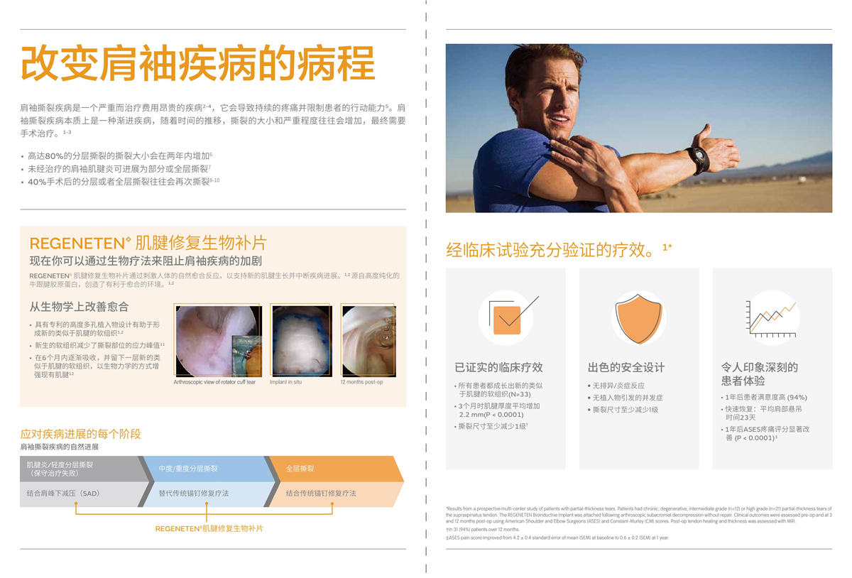 肌腱修复生物补片